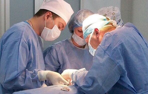 chirurgesch Behandlung vun Krampfadern